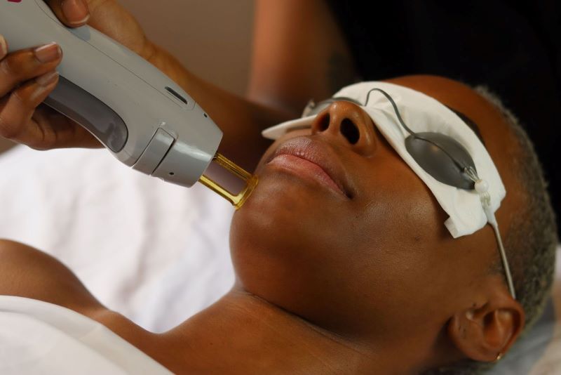 a woman receiving laser hair removal