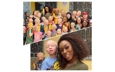 Chancel Soumah with the albino children she is supporting with her charity