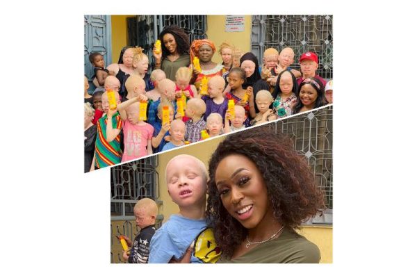 Chancel Soumah with the albino children she is supporting with her charity